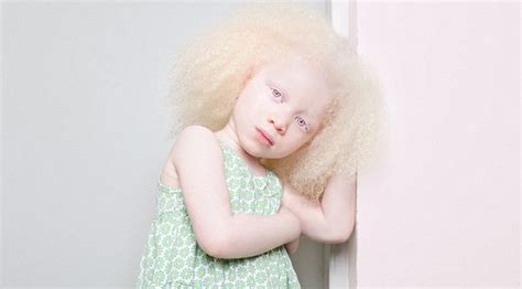 White hair is like a white sheet of paper. One in 20,000: Extraordinary albino beauty revealed in ...