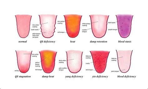 What happens if you exceed tongue weight?