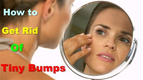 How To Get Rid Of Tiny Bumps Overnight How To Get Rid Of Tiny Bumps On