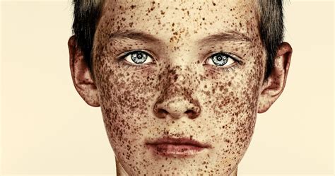 Freckles Brock Elbanks Striking Portraits In Pictures Art And