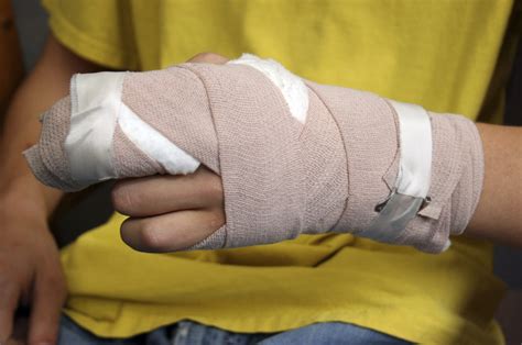 Sports Injuries Hand Treatment And Causes Orthoindy Blog