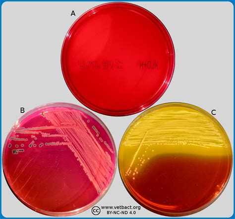 Xld agar is both a selective and differential medium. VetBact