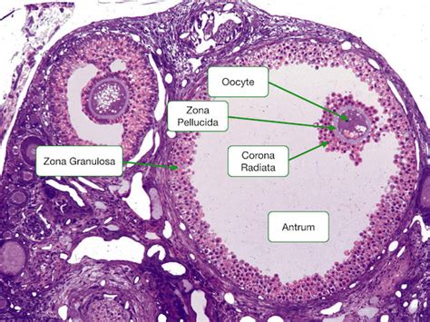 Ovary Histology Labeled