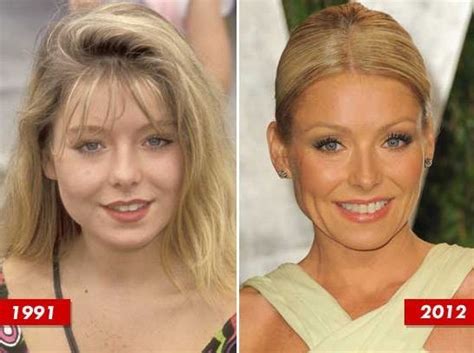 Kelly Ripa A Glamourous Personality With Plastic Surgery