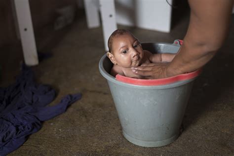 The Zika Virus May Cause Birth Defects — And Experts Think Its Coming