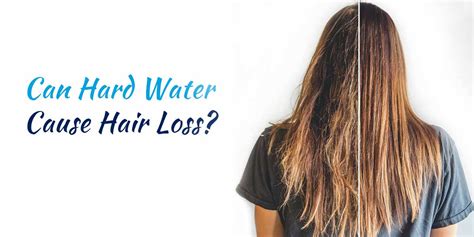 Can Hard Water Cause Hair Loss What You Can Do About It Celtic