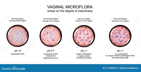 Conhecendo A Microflora Vaginal My Xxx Hot Girl