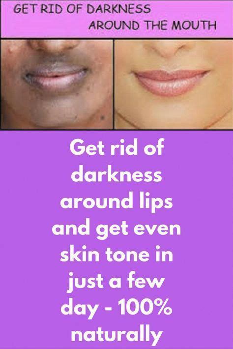 Sensitive Skin And Care Around The Lip Area Rijals Blog