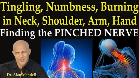 Tingling Numbness Burning In Neck Shoulder Arm And Hand Finding