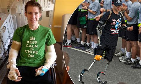 Hero Soldier Who Lost All Four Limbs In Iraq Blast Becomes First Us