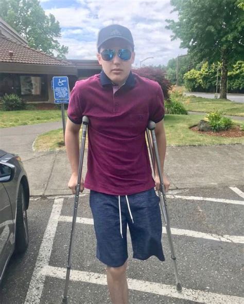 Shoulder Crutching Recent Medical Amputee Atticus