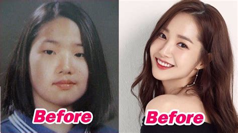 13 Korean Celebrities Who Undergo Plastic Surgery South Korean Plastic