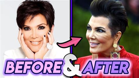 Kris Jenner Before And After Transformations Plastic Surgery Rumours Youtube