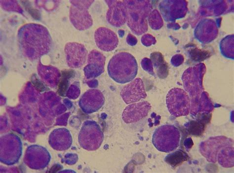 The disease has two forms: File:Canine lymphoma 1.JPG - Wikipedia