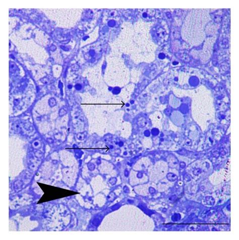 Morphology Of Renal Tubular Cells Of Hrs A C And Cin Drs B