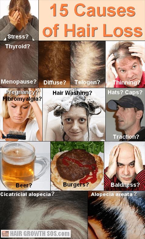 15 Causes Of Hair Loss Why Is Your Hair Falling Out