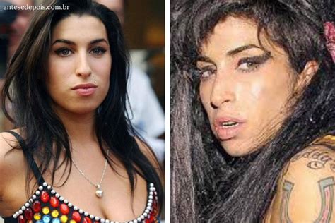 Amy Winehouse Confira Antes E Depois Da Cantora
