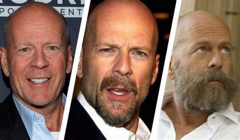 Heres Why Every Balding Man Needs To Grow A Beard Now