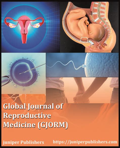 Any cancer/incurable disease mondor's disease is curable by acupressure techniques, diet, exercise, yoga. Global Journal of Reproductive Medicine (GJORM) | Juniper ...