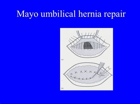 Bohomolets Surgery 4th Year Lecture 2