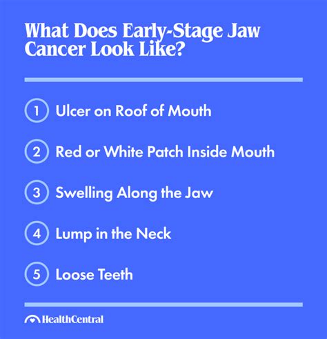 Jaw Cancer Signs Symptoms Causes Diagnosis And Treatment