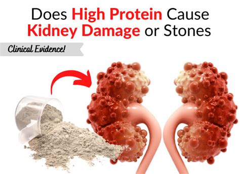 One suggests increased levels of the androgen dht after ejaculation leads to hair loss. Does High Protein Cause Kidney Damage or Stones - Clinical ...