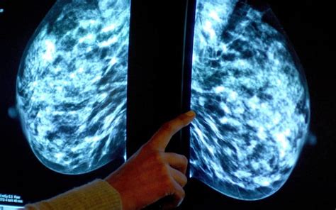 Women Who Identify As Men Not Offered Routine Nhs Breast Cancer Screening