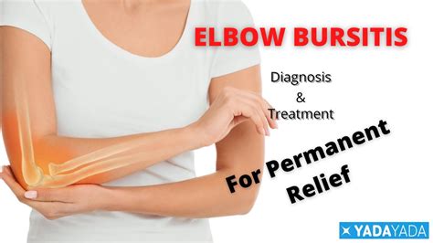 Elbow Bursitis Or Popeye Elbow Diagnosis And Aspiration Treatment Youtube