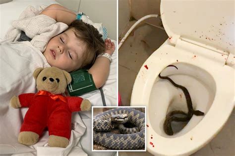 Deadly Snake Bites Are Rising Rapidly As Pythons Slither Up Loos To