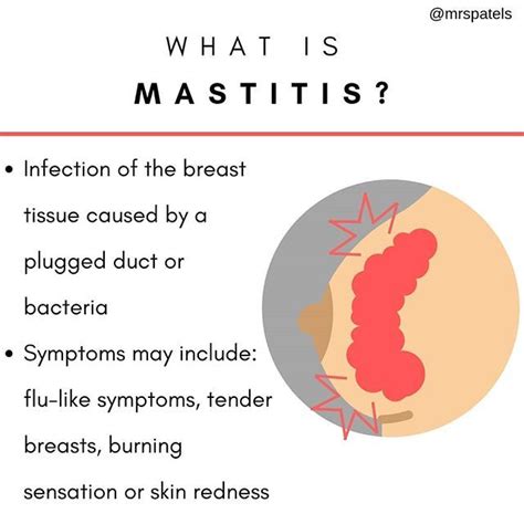 Did You Know What Is Mastitis ⠀⠀⠀⠀⠀⠀⠀⠀⠀⠀⠀⠀⠀⠀⠀⠀⠀⠀⠀⠀⠀ Mastitis Is A