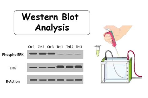 All You Need To Know About The Western Blots And Their Importance In