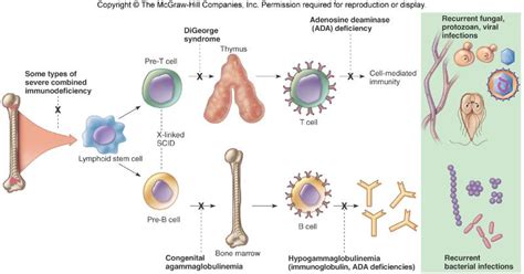 My Notes For Usmle — Immunodeficiency Diseases Complete Functional B