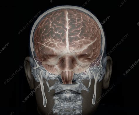 The cerebellum, latin for little brain. Brain and skull anatomy, 3D CT scan - Stock Image - C033 ...
