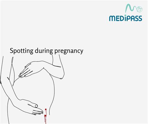 Spotting During Early Pregnancy Medipass