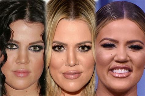 Are you shitting me the before picture is kylie jenner i can't believe y'all are falling for these. 'I'm Not On Drugs!' — Khloe Kardashian Defends Herself ...