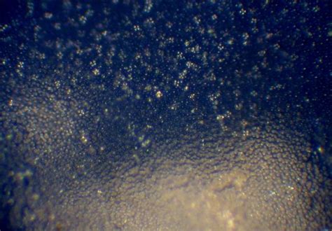 Clytocybe Nébuleux (?) - Mycologie microscopique - Mikroscopia