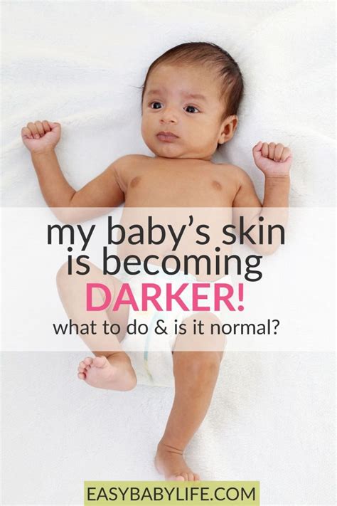 How Baby Skin Color Changes Babys Skin Is Getting Darker Baby