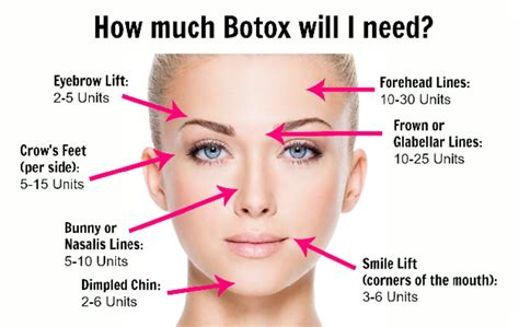 How Much Is Botox Cosmetic Injections 8u Mission Viejo Ca