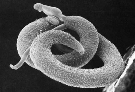 Life History Of The Blood Fluke Schistosoma Sp Owlcation