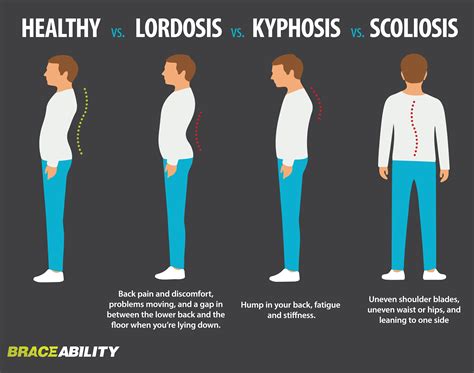Healthy Vs Lordosis Vs Kyphosis Vs Scoliosis Spine Health Pinterest Scoliosis And Exercises
