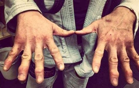 How To Save Your Jacked Up Fingers In Bjj