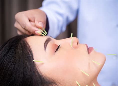 The Healing Touch Find Acupuncturists Ready To Transform Your Practice