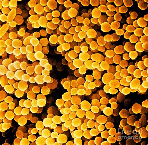 Staphylococcus Aureus Sem Photograph By David M Phillips