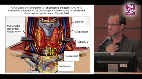 Surgical Treatment For Papillary Thyroid Cancer Contra Central Neck