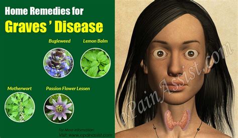 Home Remedies For Graves Disease Graves Disease Home Remedies Remedies