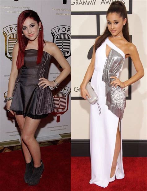 Ariana Grande Before And After The Power Of Plastic Surgery Demotix