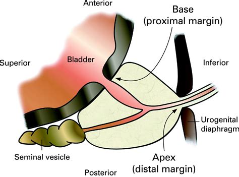 Anatomical Position Of Prostate Gland
