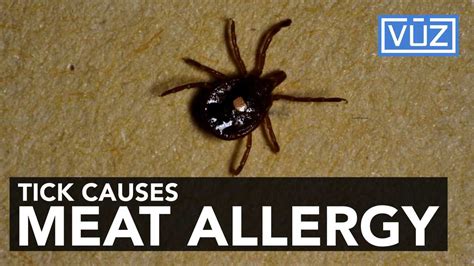 Lone Star Tick Causes Meat Allergy