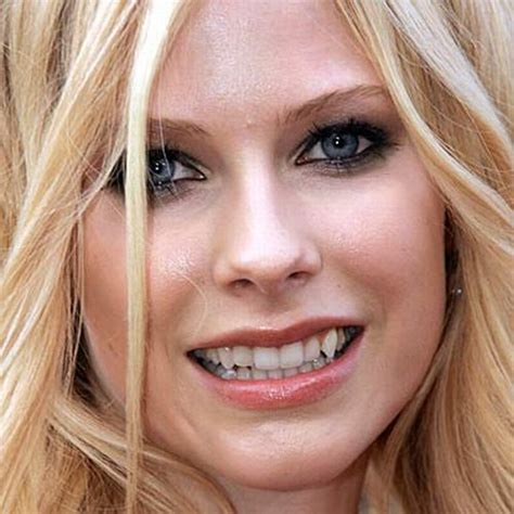 Celebrities With Bad Teeth 13 Pics