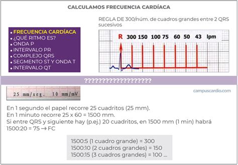 Calcula La Frecuencia Cardíaca En El Siguiente Electrocardiograma